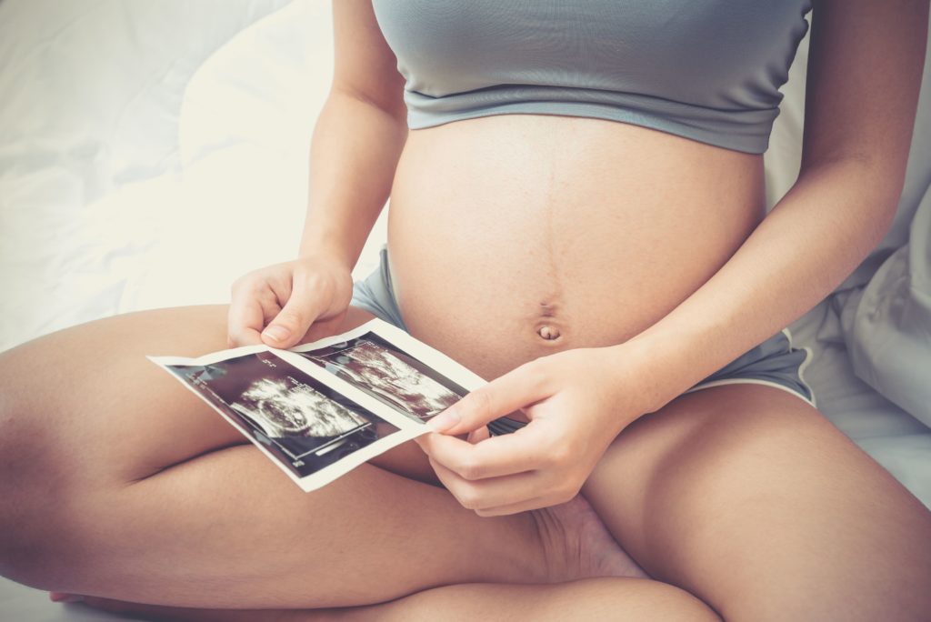 mulher grávida segurando uma imagem de ultrassom